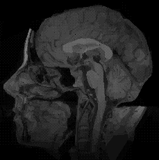 Brain Slice(BSP Tree)