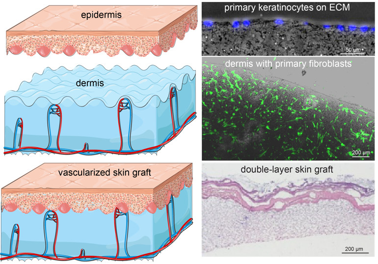Vascularized skin grafts